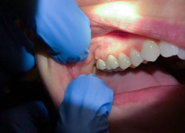 Best Emergency Orthodontic Repairs in Swainsboro, GA