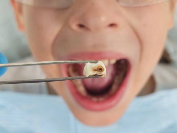 Best Emergency Orthodontic Repairs in Swainsboro, GA